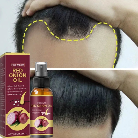 Powerful Hair Growth Serum Spray Regrowth Hair Anti Hair Loss Treatment Essence Repair Hair Nourish Root For Men Women Hair Care